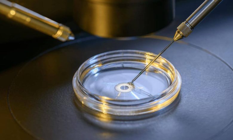 درمان ناباروری با آی وی اف (IVF)